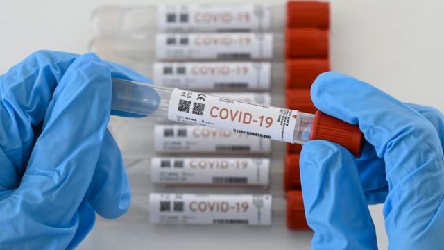 Detectan en Puerto Rico la variante de COVID-19 originada en Reino Unido