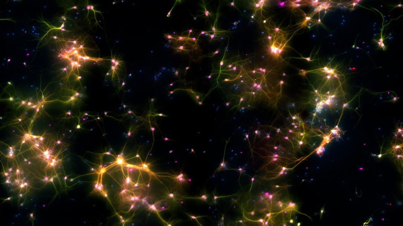 Estudio afirma que neuronas en una placa de laboratorio aprendieron a jugar Pong
