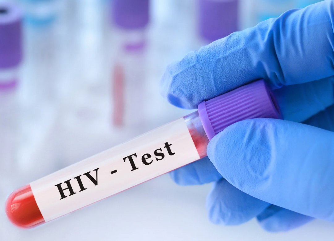 Primeros casos de VIH por procedimiento cosmético